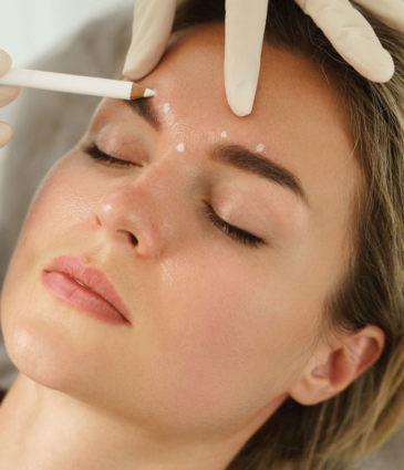 Binsina Laser Clinic - Wrinkle Relaxing Injections