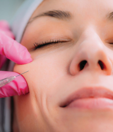 Binsina Laser Clinic - Dermal Fillers