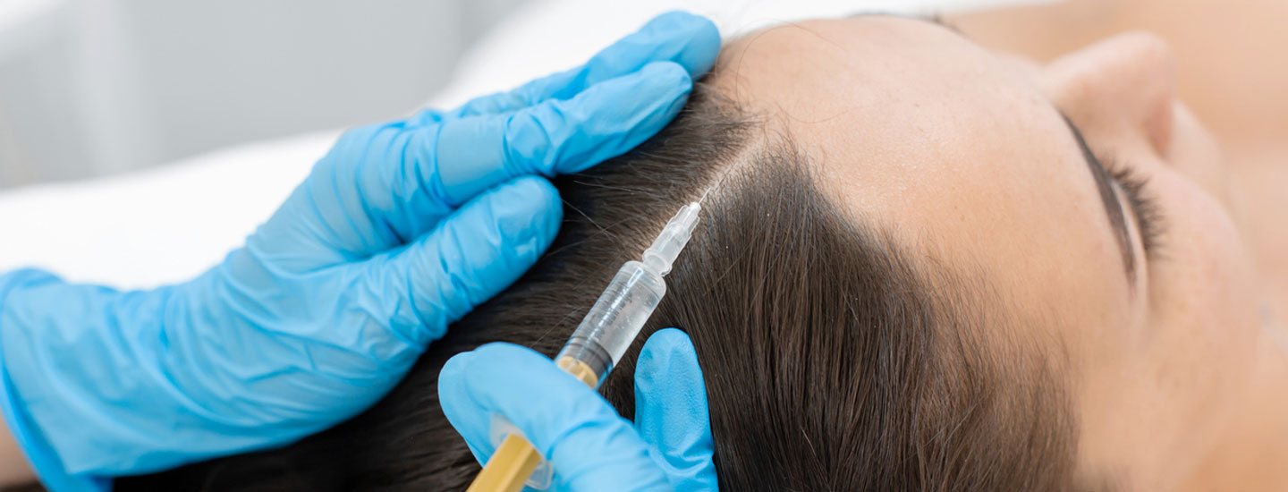 Binsina Skin & Laser Clinic - Hair Restoration (Plasma Therapy)