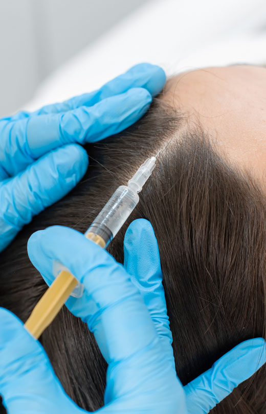 Binsina Skin & Laser Clinic - Hair Restoration (Plasma Therapy)