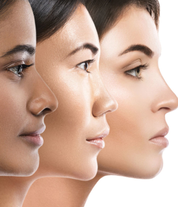 Binsina Laser Clinic - Plasma Therapy (face)