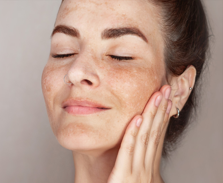 Binsina Skin & Laser Clinic - Age Spots