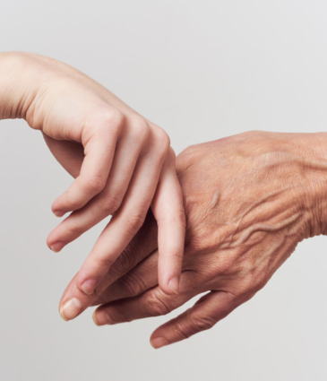 Binsina Skin & Laser Clinic - Ageing Hands