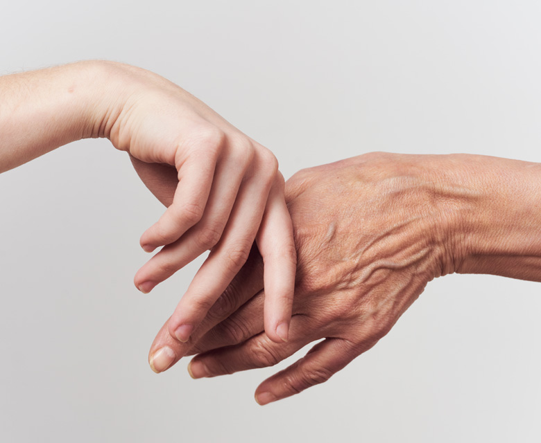 Binsina Skin & Laser Clinic - Ageing Hands