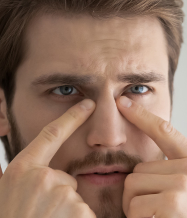 Binsina Skin & Laser Clinic - Dark Circles