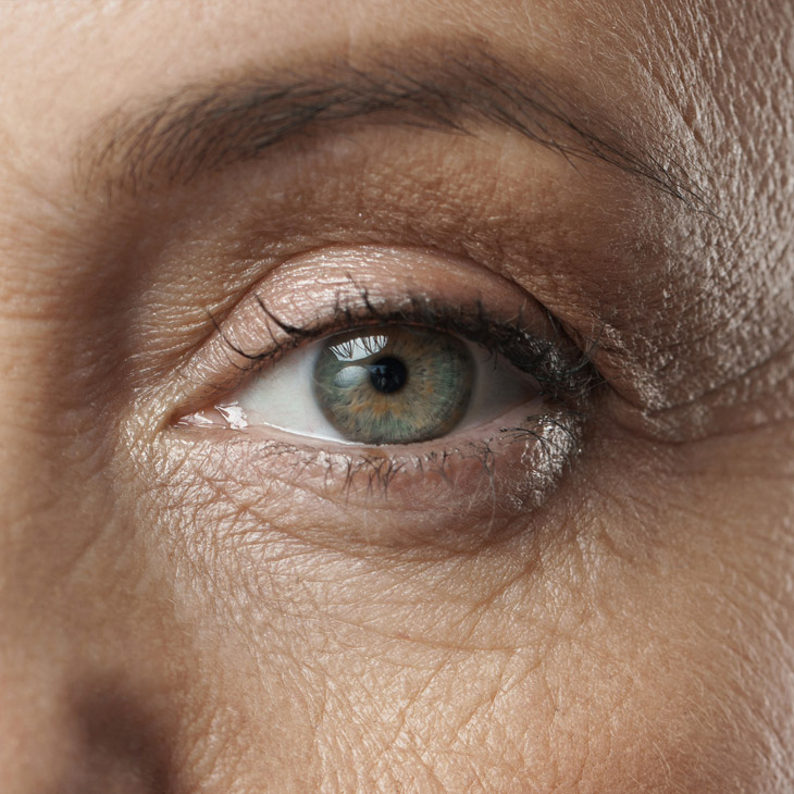 Binsina Skin & Laser Clinic - Eye Bags 3