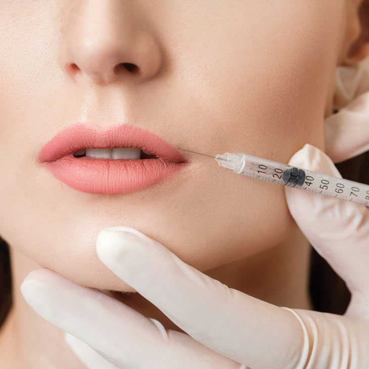 Binsina Skin & Laser Clinic - Lip Fillers 2