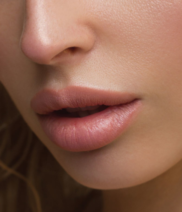 Binsina Skin & Laser Clinic - Lip Fillers
