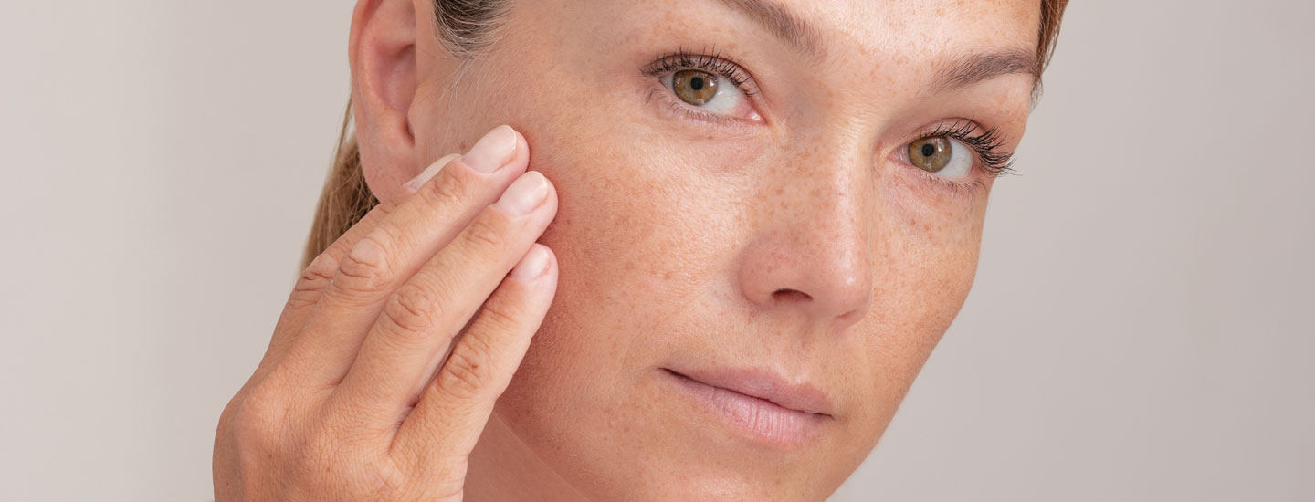 Binsina Skin & Laser Clinic - Mole Removal