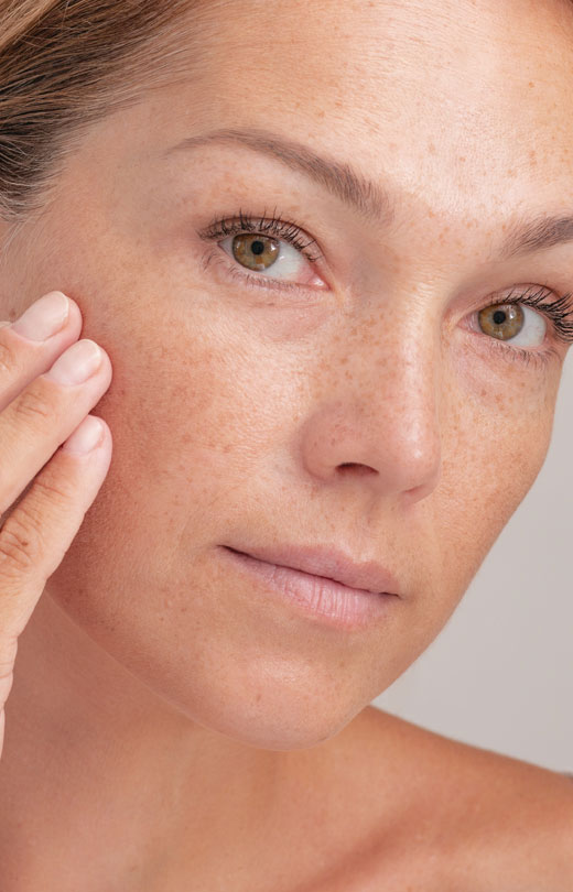 Binsina Skin & Laser Clinic - Mole Removal