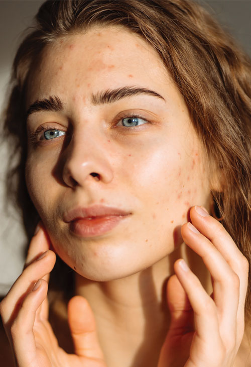 Binsina Skin & Laser Clinic - Conditions Menu