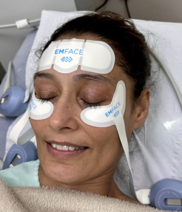 Binsina Laser Clinic - EMFACE 3