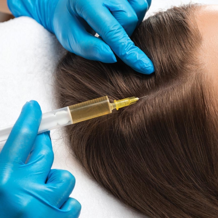 Binsina Skin & Laser Clinic - Why PRP Hair Restoration Is Transforming Confidence